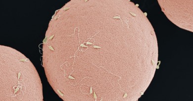 Immagine al microscopio elettronico a scansione di spermatozoi sullasuperficie di un uovo di riccio di mare non fecondato