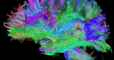 ricostruzione trattografica dei percorsi delle principali connessioni cerebrali eseguita con risonanza magnetica ad alto campo